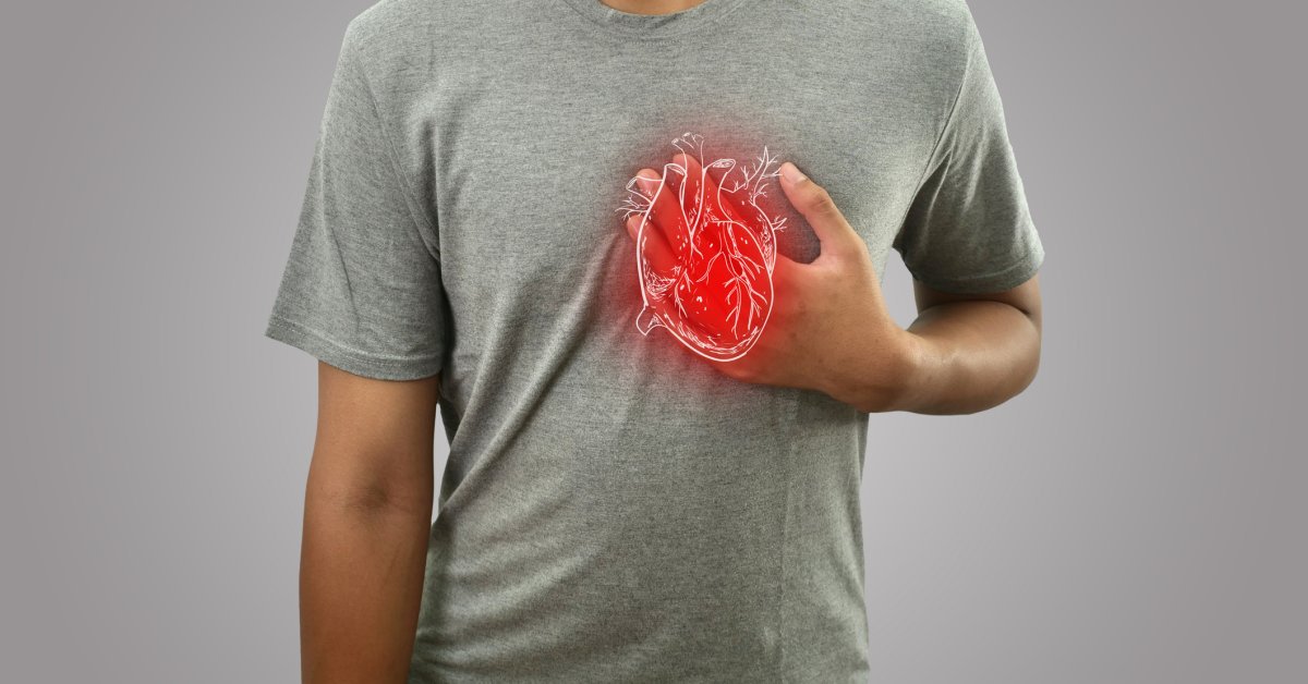 Myths About Cardiomyopathy—Debunked | TIME